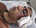 مصدومیت دانش‌آموز در دهبکری؛ معلم تعلیق شد و پرونده قضایی تشکیل شد